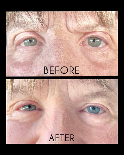 Hydrogel Eye Patches with Peptide + Collagen