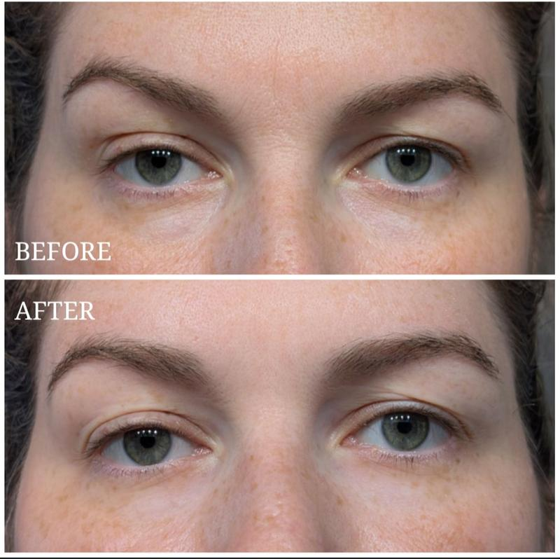 Hydrogel Eye Patches with Peptide + Collagen