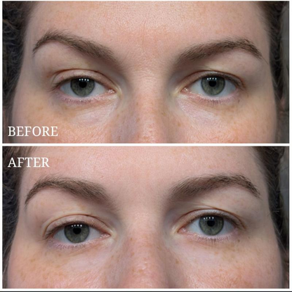 Hydrogel Eye Patches with Peptide + Collagen