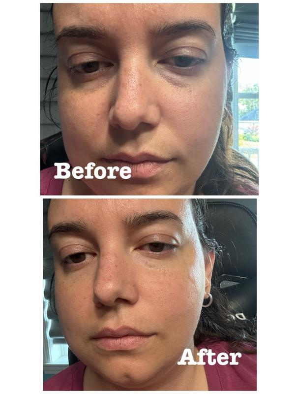 Hydrogel Eye Patches with Peptide + Collagen