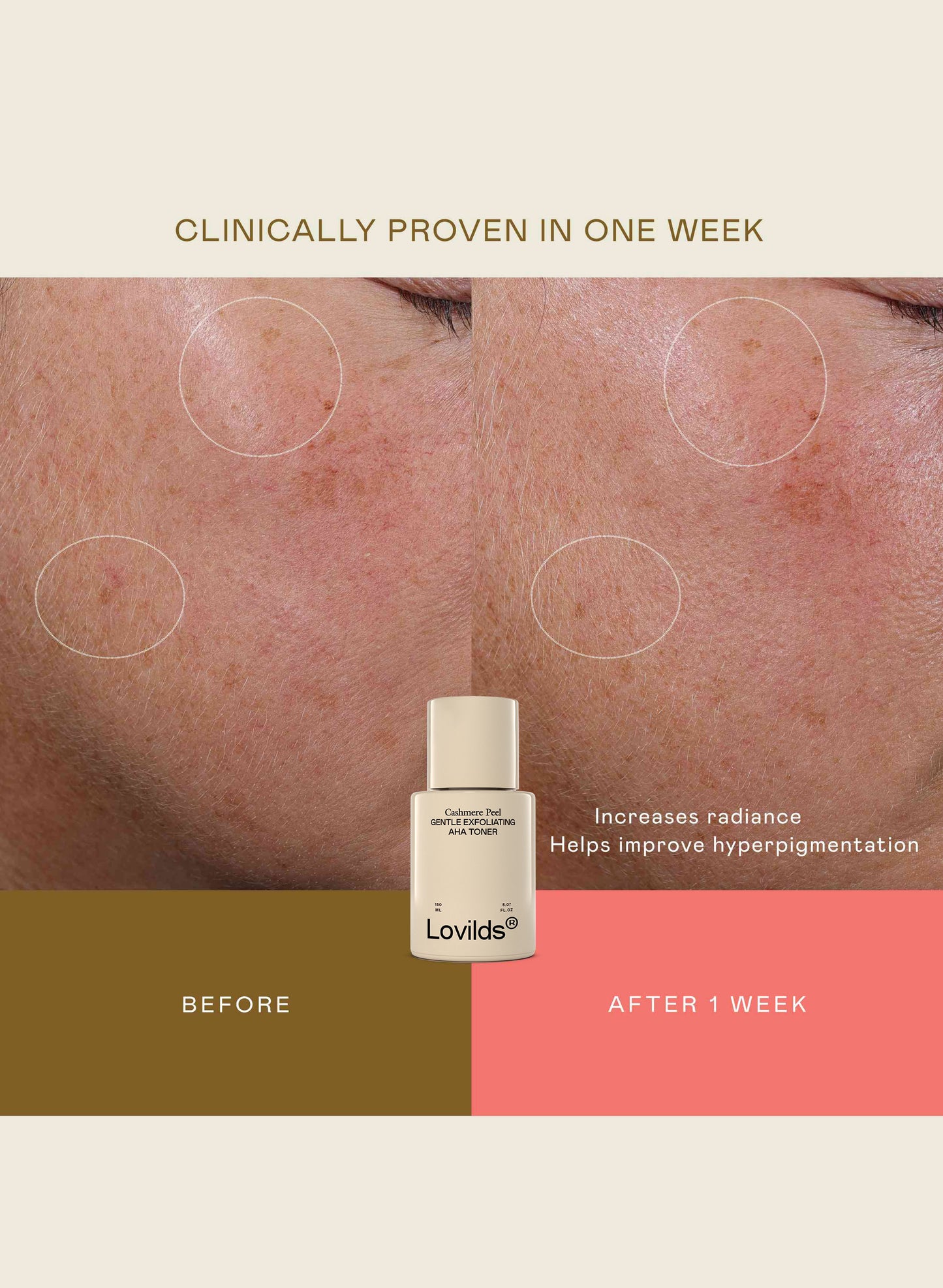 Lovilds® Cashmere Peel