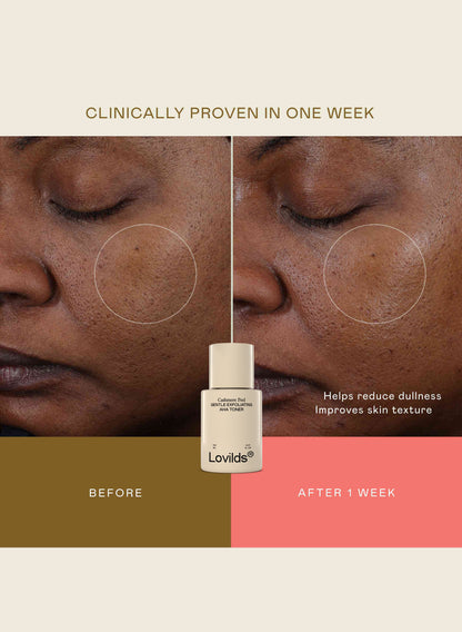 Lovilds® Cashmere Peel